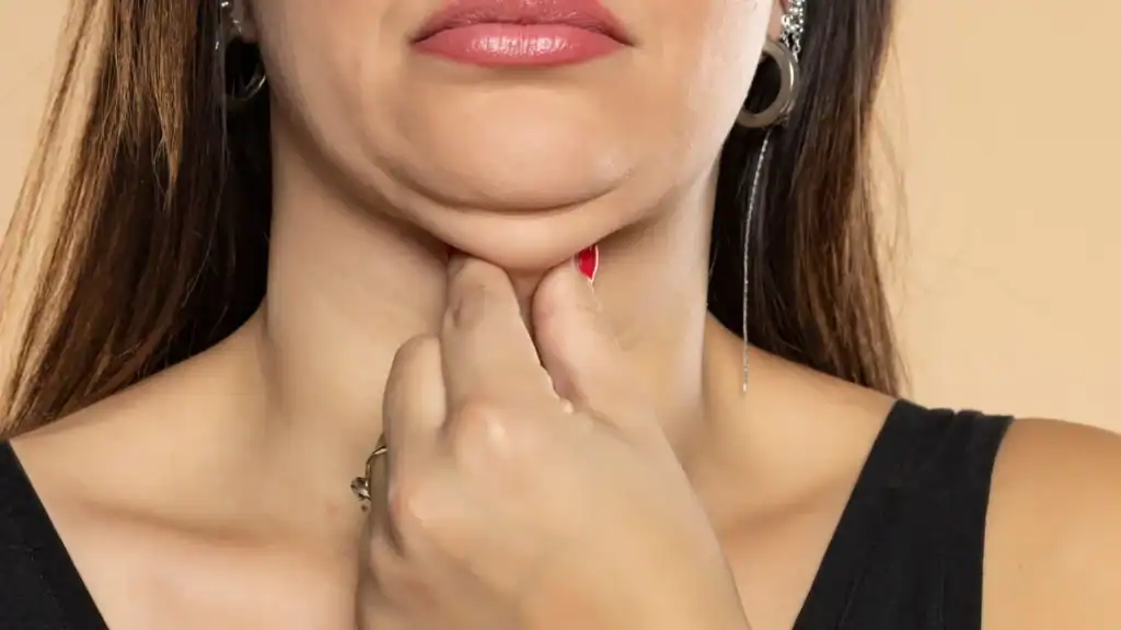 An image of a woman with double chin, sad, worried : Non Surgical Double Chin Removal Treatment in Ware, UK