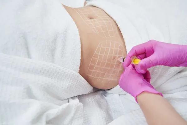 image of fat dissolving injections on love handles to help combat weight gain Ware