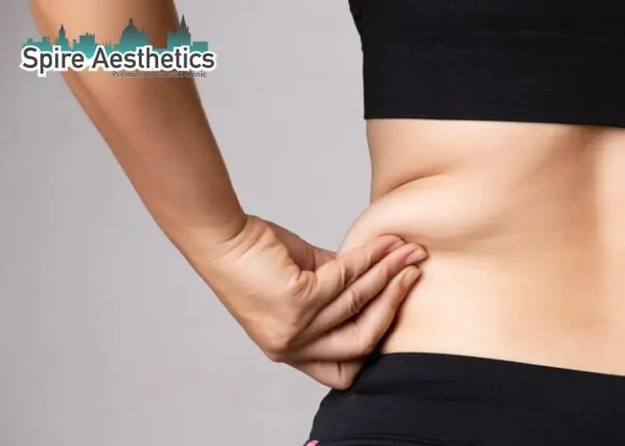 Image of woman pinching fat on their hips Ware. Fat Freezing treatment