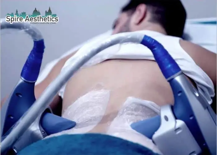 Man having fat freezing treatment done on love handles before a competitions Ware to create a sculpted look.