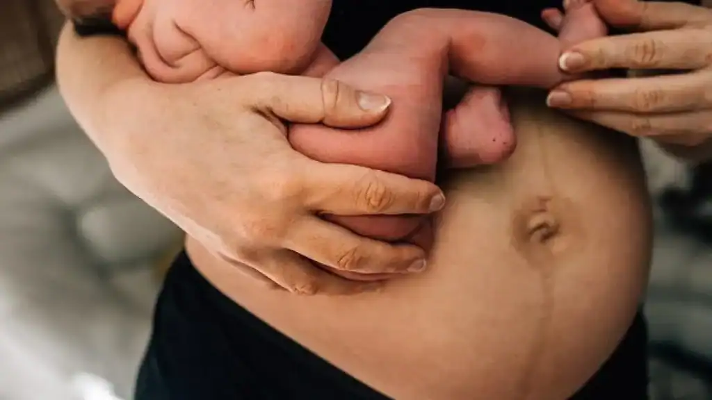 Why Is My Stomach Still Big After Pregnancy Ware?