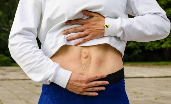 When Could Diastasis Recti Be the Missing Piece of the Puzzle Ware?